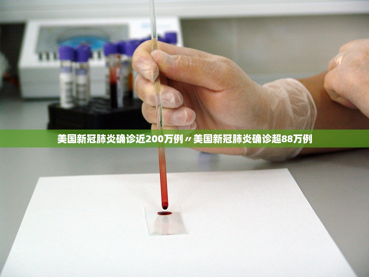 美国新冠肺炎确诊近200万例〃美国新冠肺炎确诊超88万例 美国新冠肺炎确诊近200万例〃美国新冠肺炎确诊超88万例