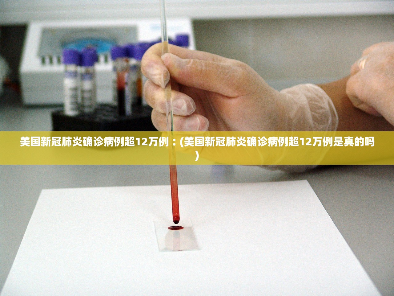 美国新冠肺炎确诊病例超12万例︰(美国新冠肺炎确诊病例超12万例是真的吗) 美国新冠肺炎确诊病例超12万例︰(美国新冠肺炎确诊病例超12万例是真的吗)